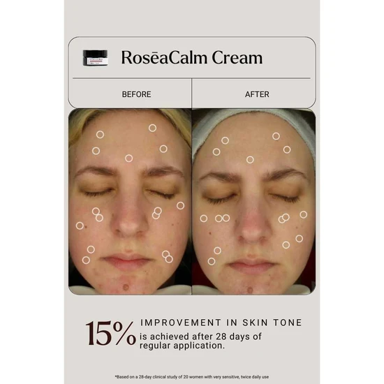 NAYA RoseaCalm Cream 5ml