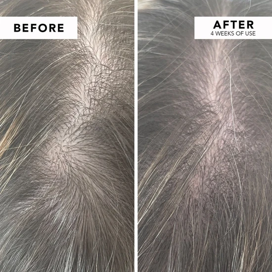 WE ARE PARADOXX Growth Accelerate Advanced Scalp Serum 50ml