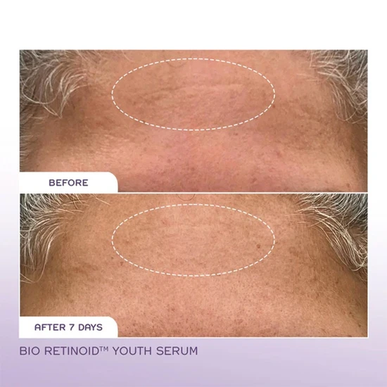 REN Bio Retinoid Youth Serum Suitable For Sensitive Skin 15ml