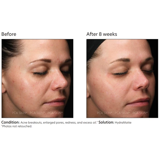 PCA SKIN HydraMatte