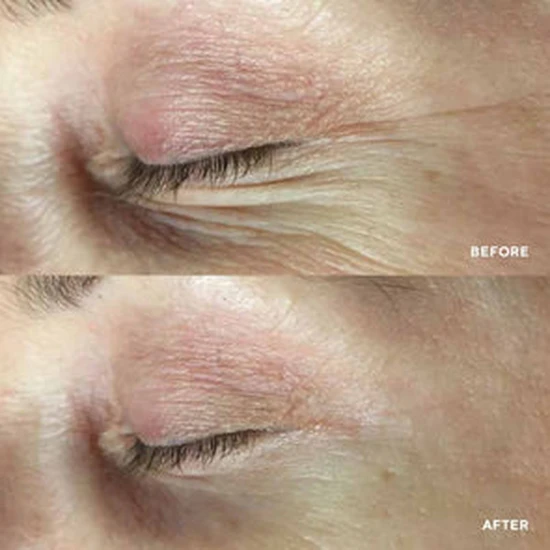 HydroPeptide PolyPeptide Collagel+ Mask For Eyes Pack of 8