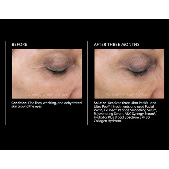 PCA SKIN Rejuvenating Serum 29.5ml