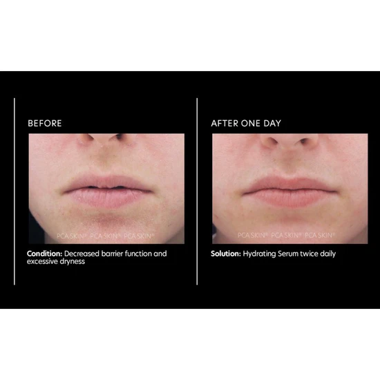 PCA SKIN Hydrating Serum 30ml