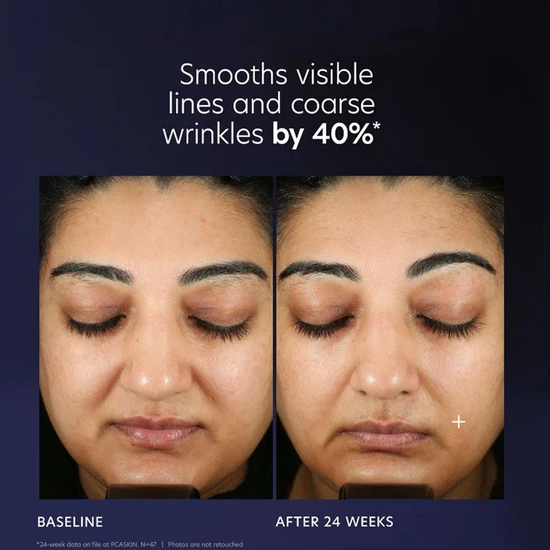 PCA SKIN Pro-Max Age Renewal Serum