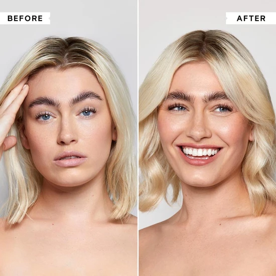 Philip Kingsley Flaky/Itchy Scalp Anti-Dandruff Shampoo 75ml