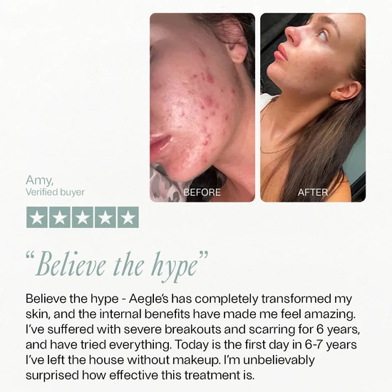 Aegle's Clear Skin Complex