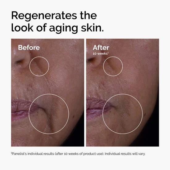 The Ordinary The Renewal Limited Edition Skin Care Gift Set