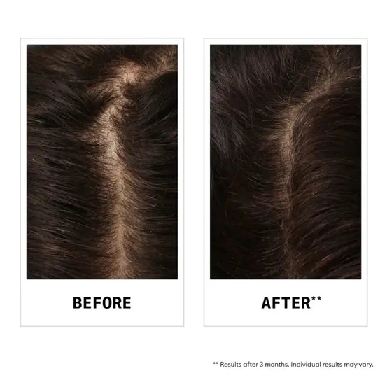 Wella Nioxin Hair Fall Defence Shampoo 240ml