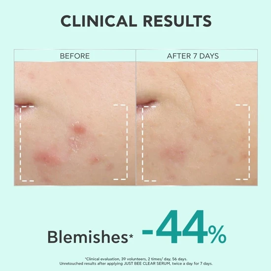 APIVITA Just Bee Clear Refining Serum 30ml