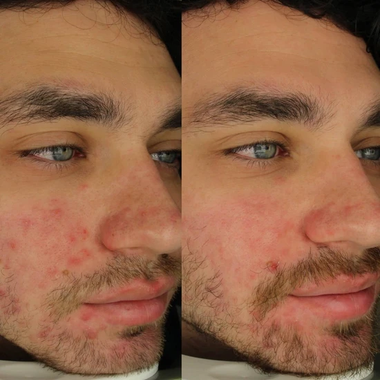 AMELIORATE Overnight Clearing Therapy 15ml