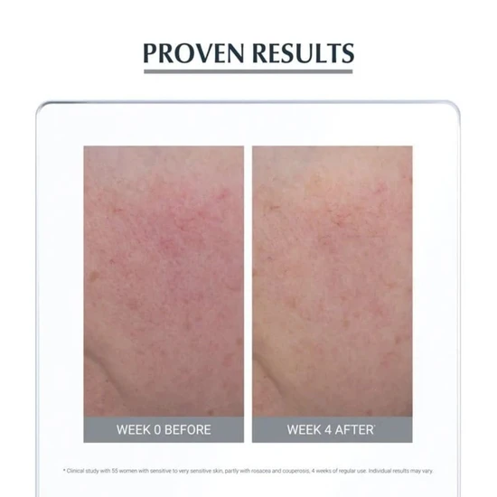 Eucerin Anti-Redness Soothing Care 50ml