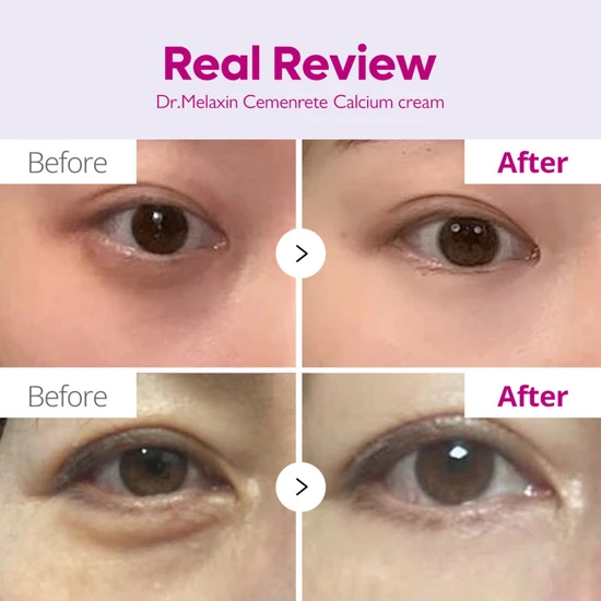 Dr.Melaxin Cemenrete Calcium Intense Cream 50ml