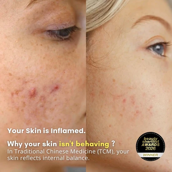 LUWIN Ultimate Repair & Clear Face Cream For Acne-prone Skin 50ml
