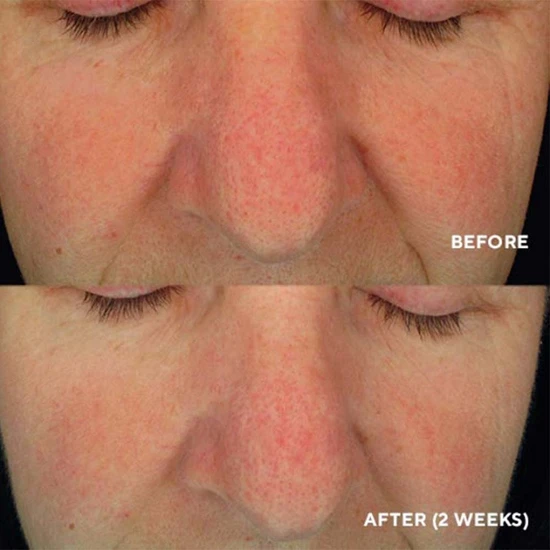 HydroPeptide Soothing Serum Redness Repair & Relief 30ml