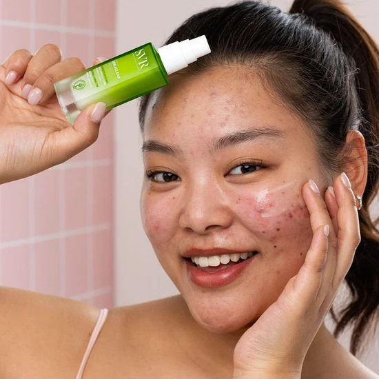 SVR SEBIACLEAR Anti-Ageing Acne Serum 30ml