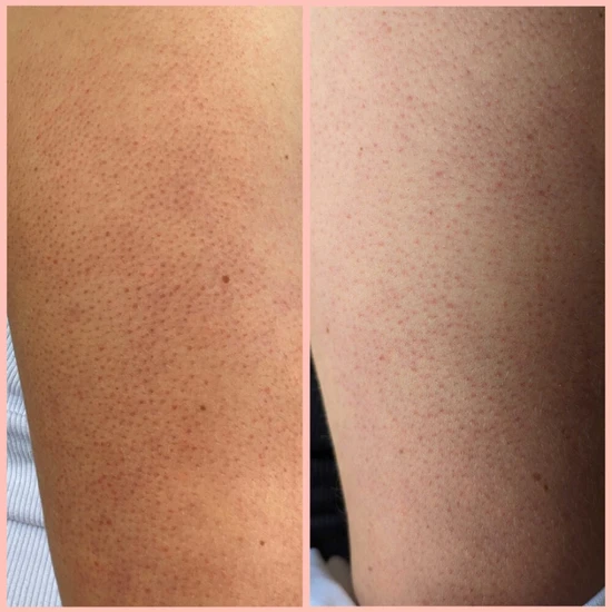 Frank Body Glycolic Body Scrub 250g